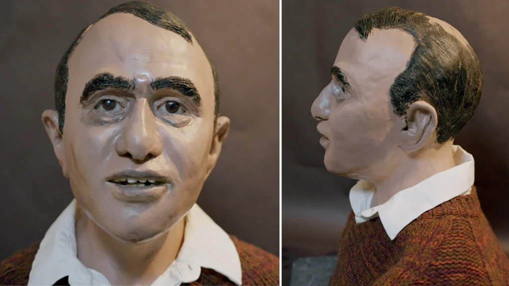 Facial reconstruction